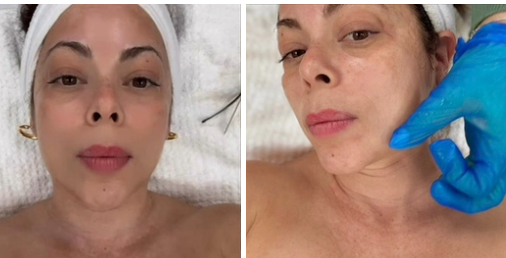 Timeless Beauty (Anti-Aging Facial)