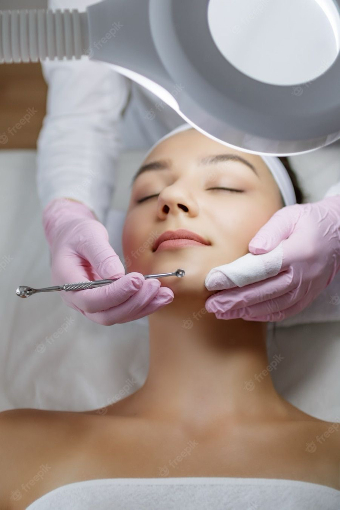 Acne Facial
