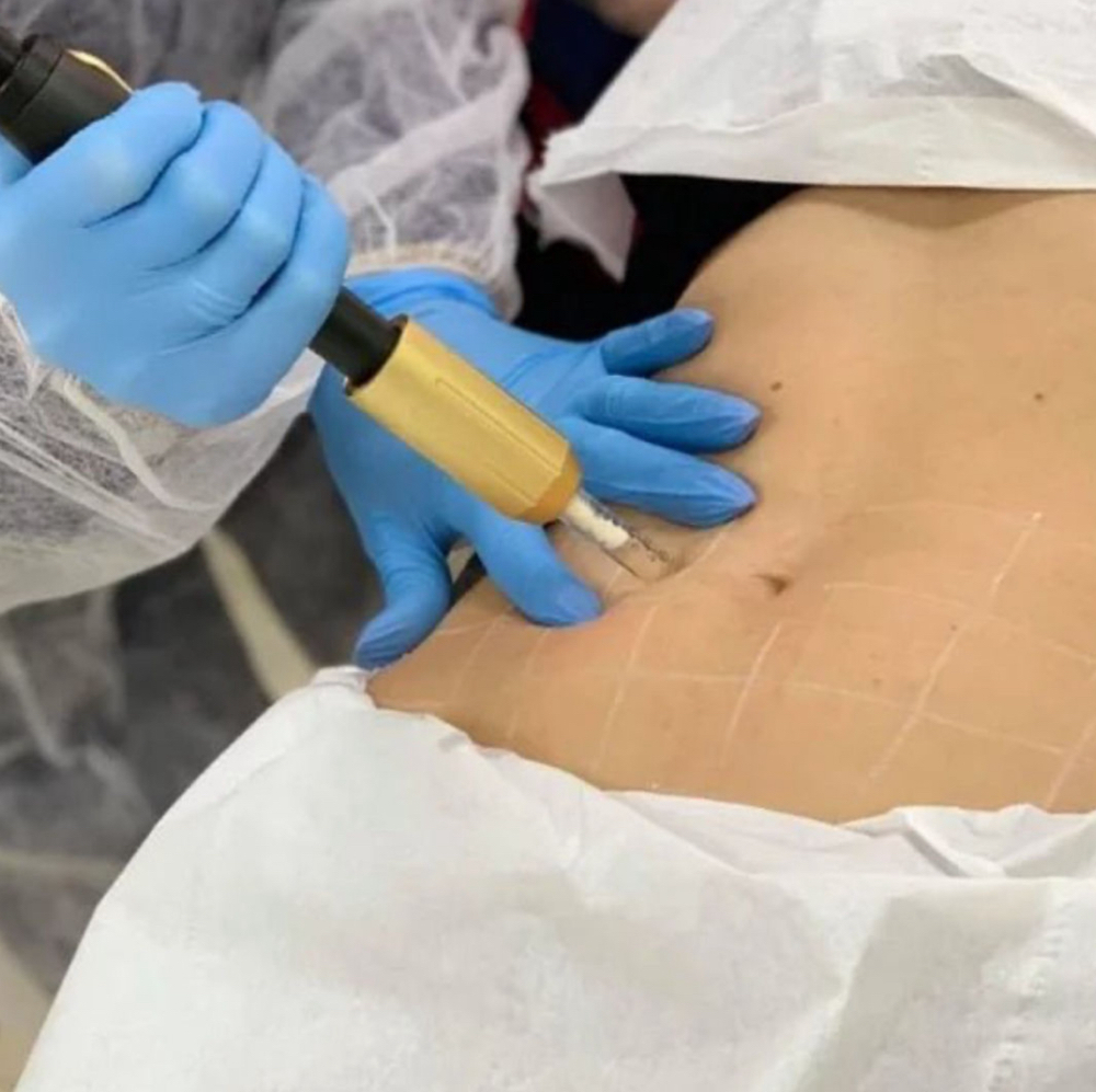 Virtual Mesotherapy