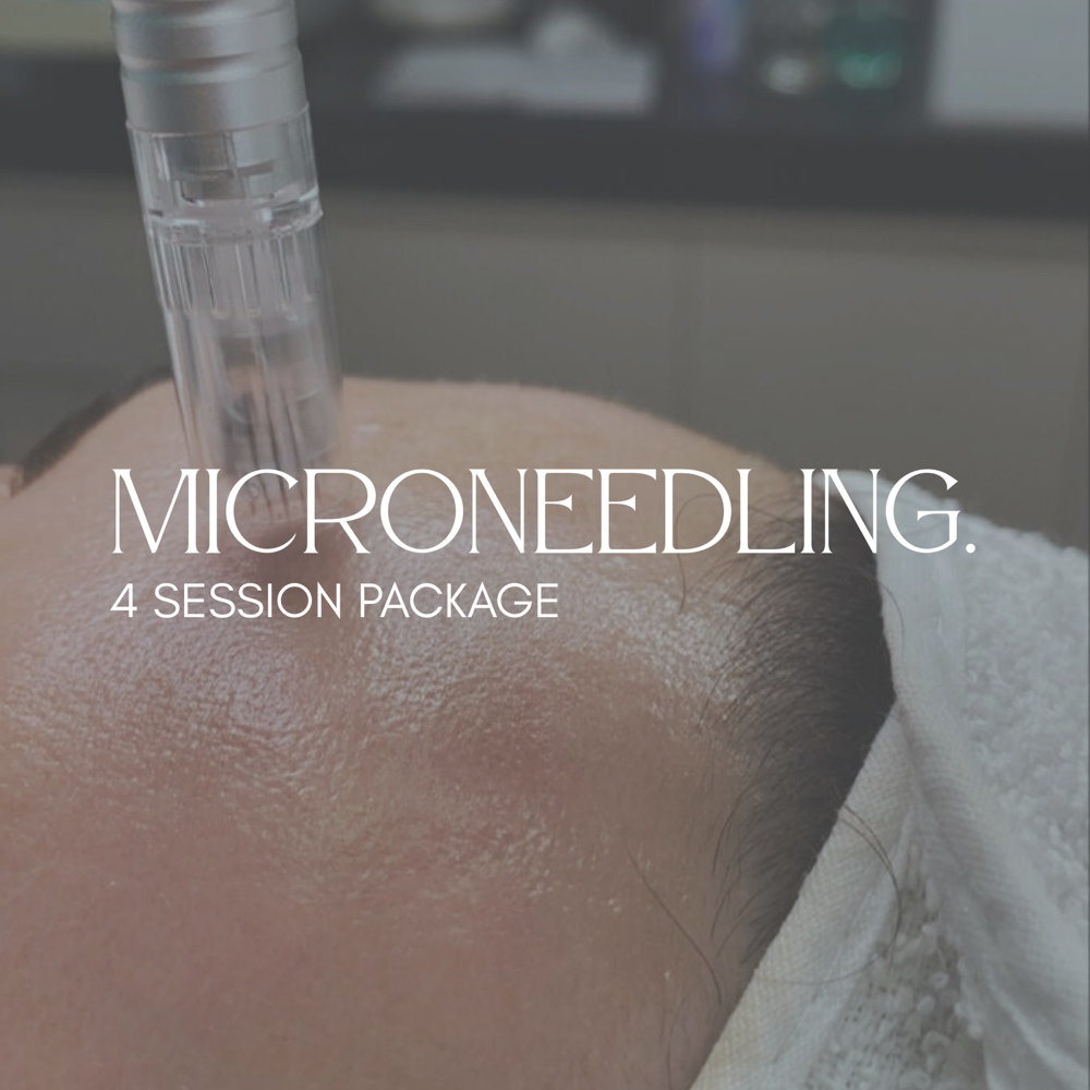 Microneedling - 4 Session Package at Trentuno Skin Studio in Concord, NC