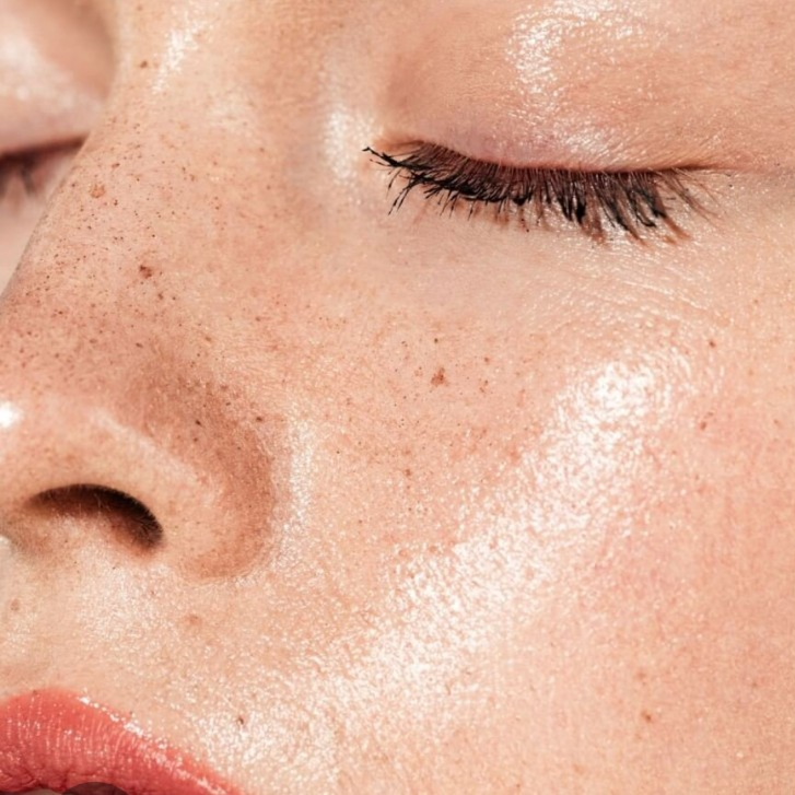 The Complexion Reset Peel at Magnolia Skin Spa in Youngsville, NC