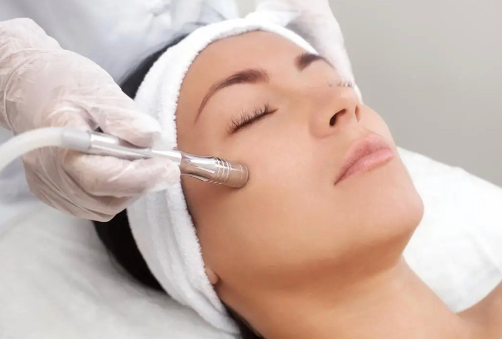 Microdermabrasion Facial (45 Min)