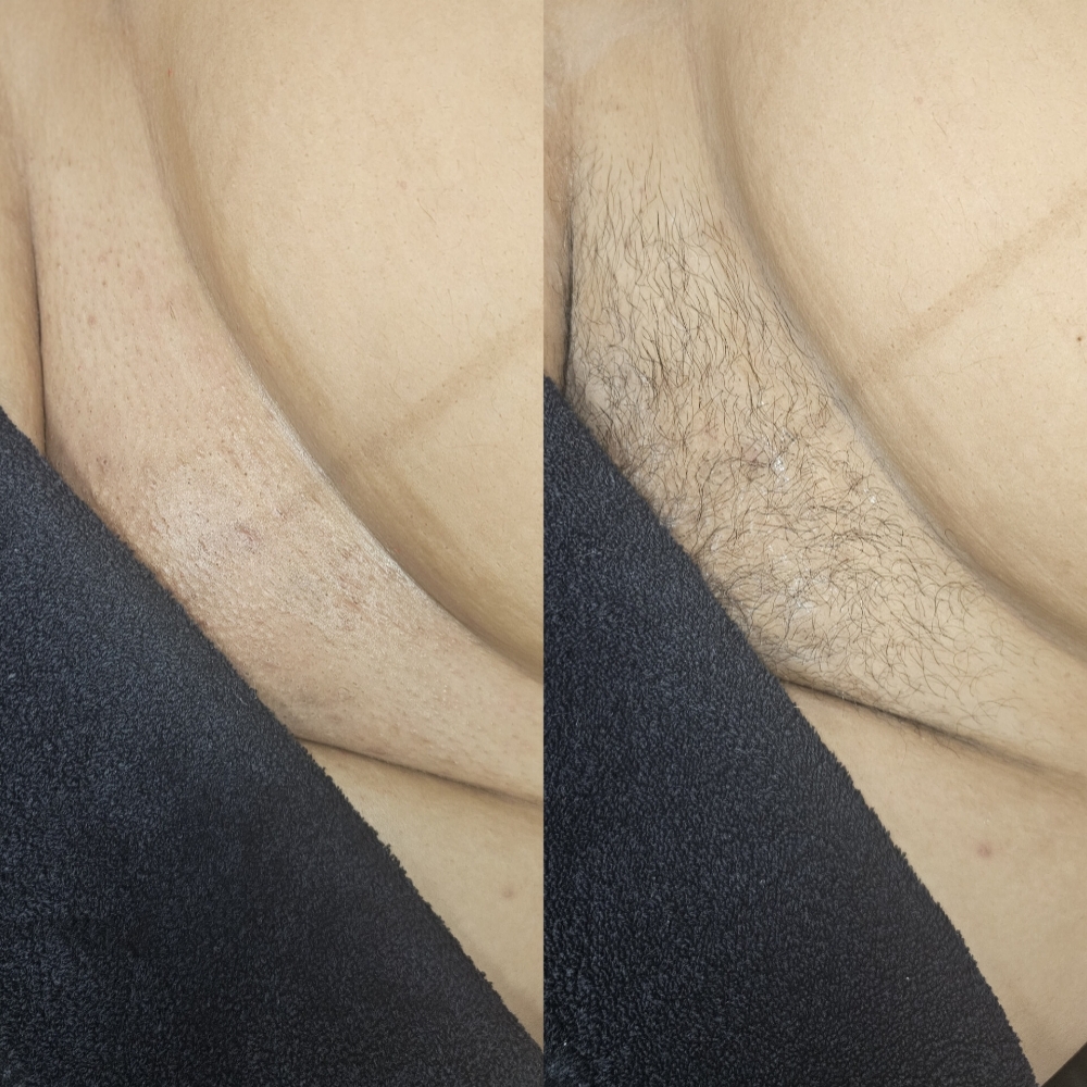 Brazilian Wax at Bubalu Skin in Elgin, IL
