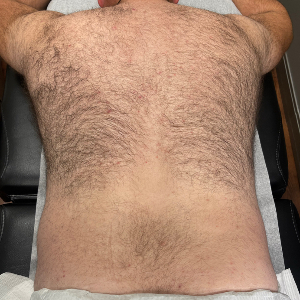 Full Back at Glowology Esthetics in Papillion, NE