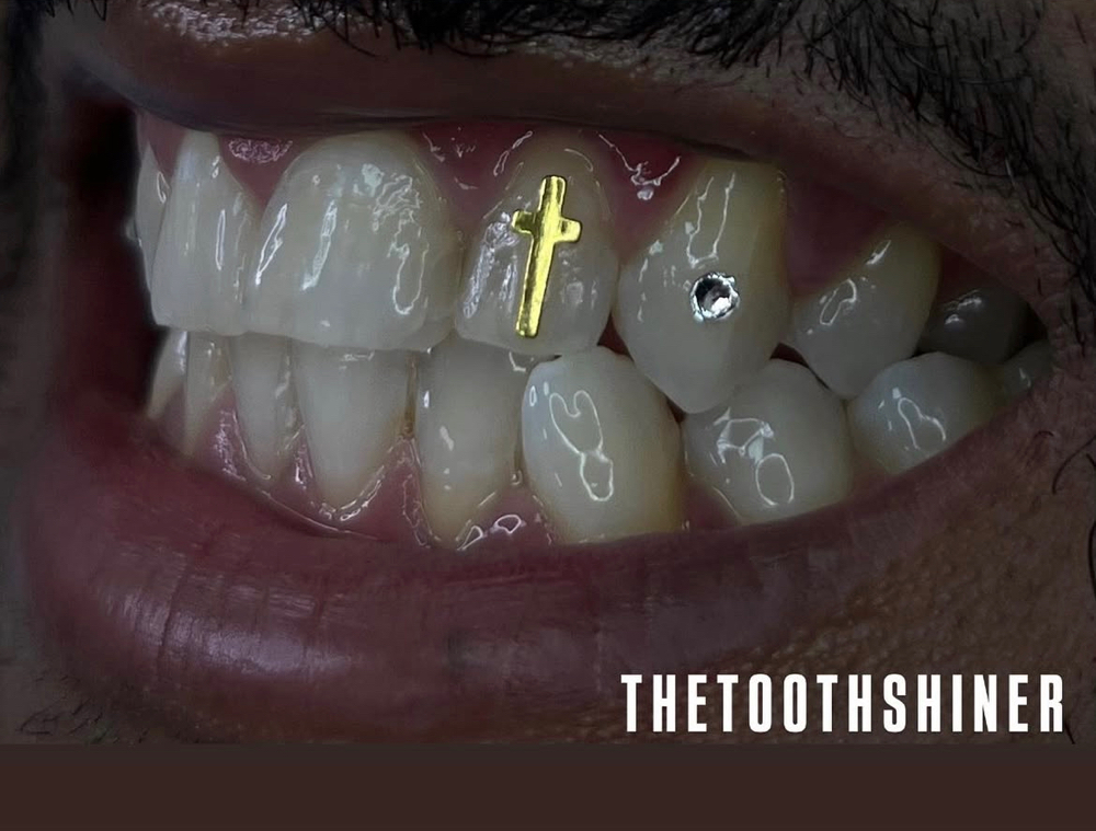 Tooth Gem Replacement