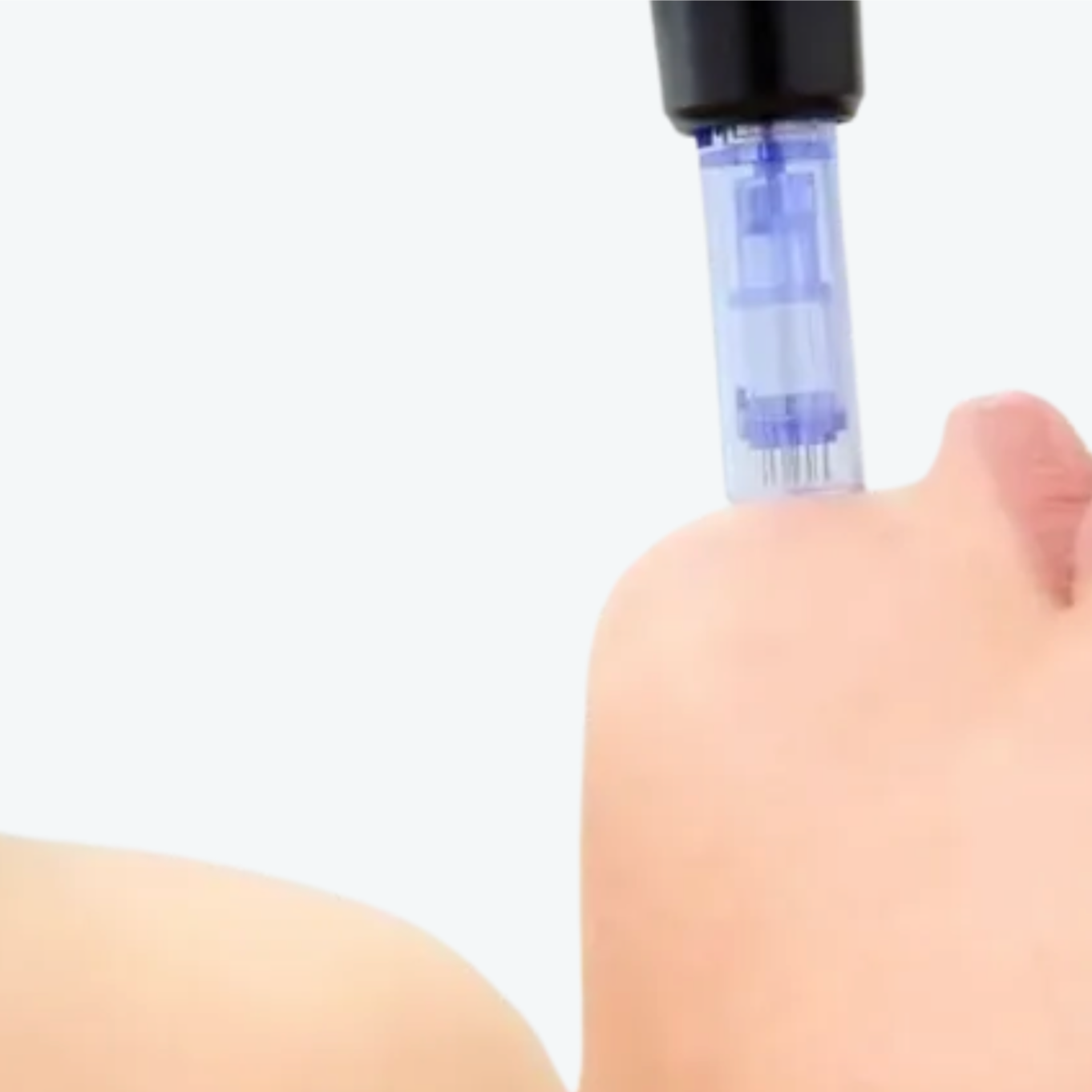 Cosmetic Microneedling at Salon Ombre in La Junta, CO