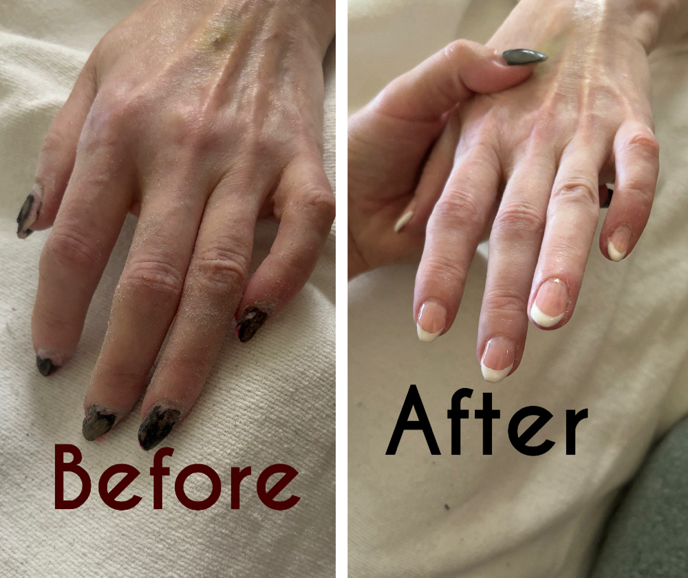 Nail Repair