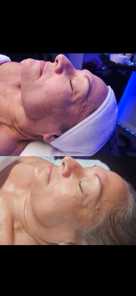 The Forever Young Facial