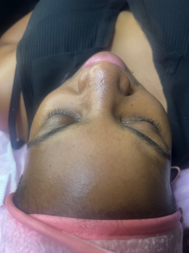 Hydro Glow Facial