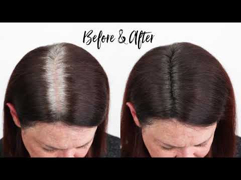 Root Touch-Up