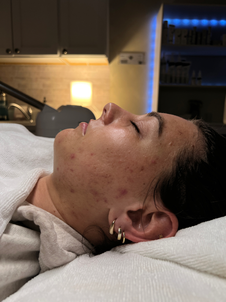 Teen Facial