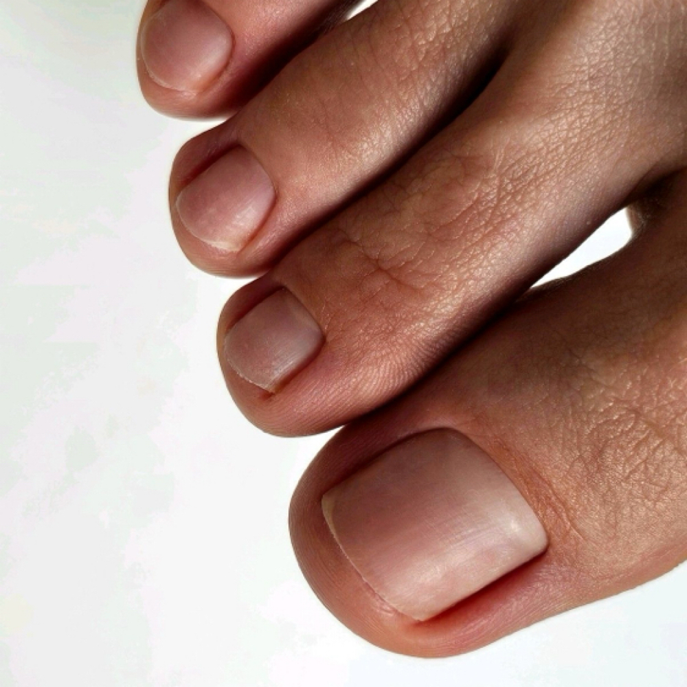 Toe Nail Trim at Noemi nail art & spa in Seneca, SC