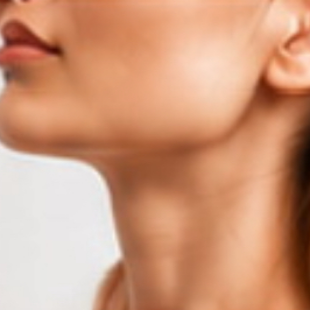 Fusion Plasma Neck Tightening at Plasmalift Skin Clinic LLC in Bettendorf, IA