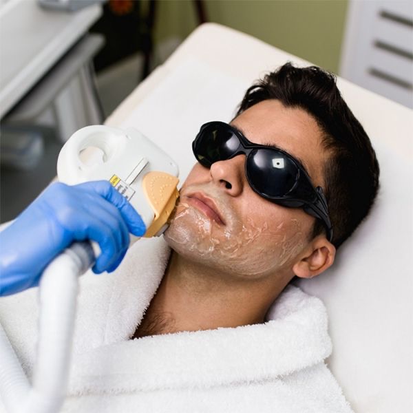 BARBA COMPLETA LASER
