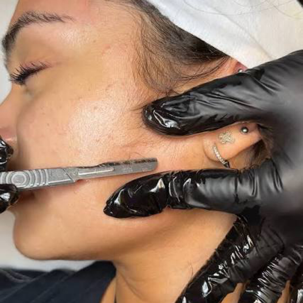 Facial Add On (Dermaplane)