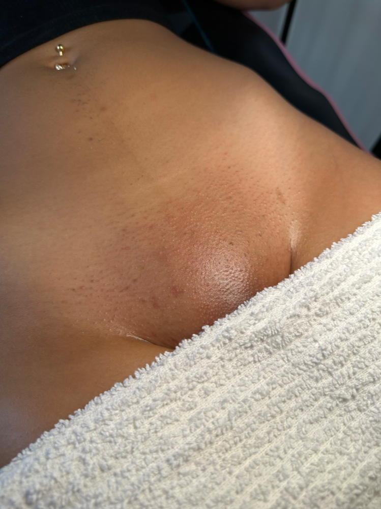 Brazilian Wax (Female)