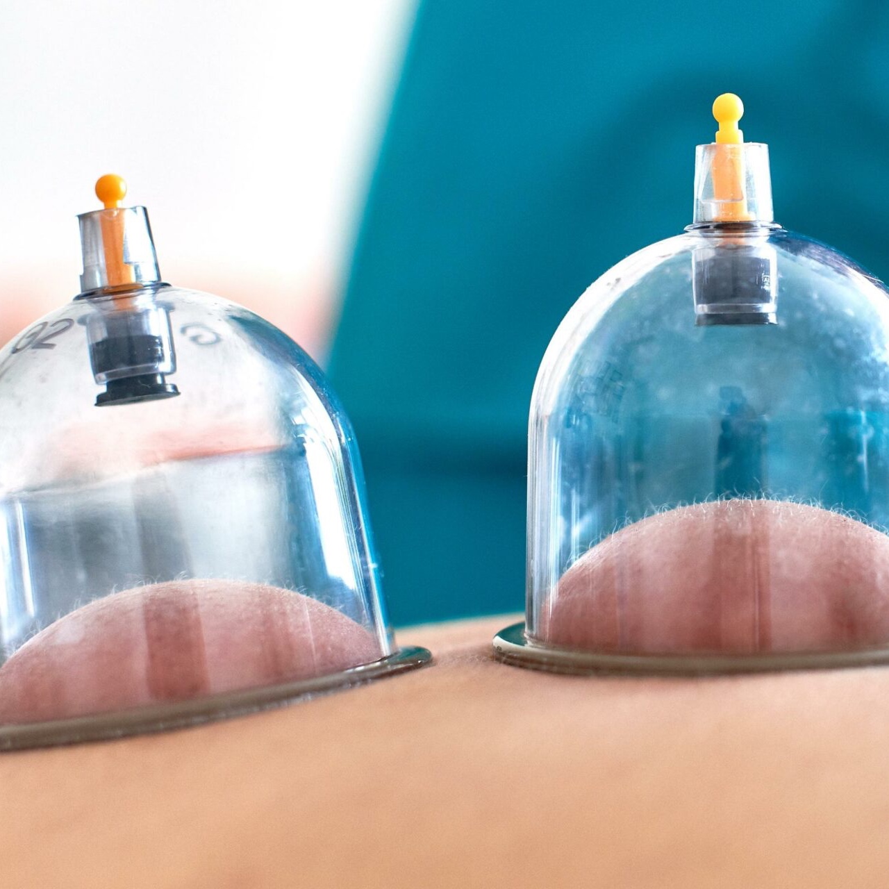 Cupping Massage at Massage by Cori in Urbana, OH