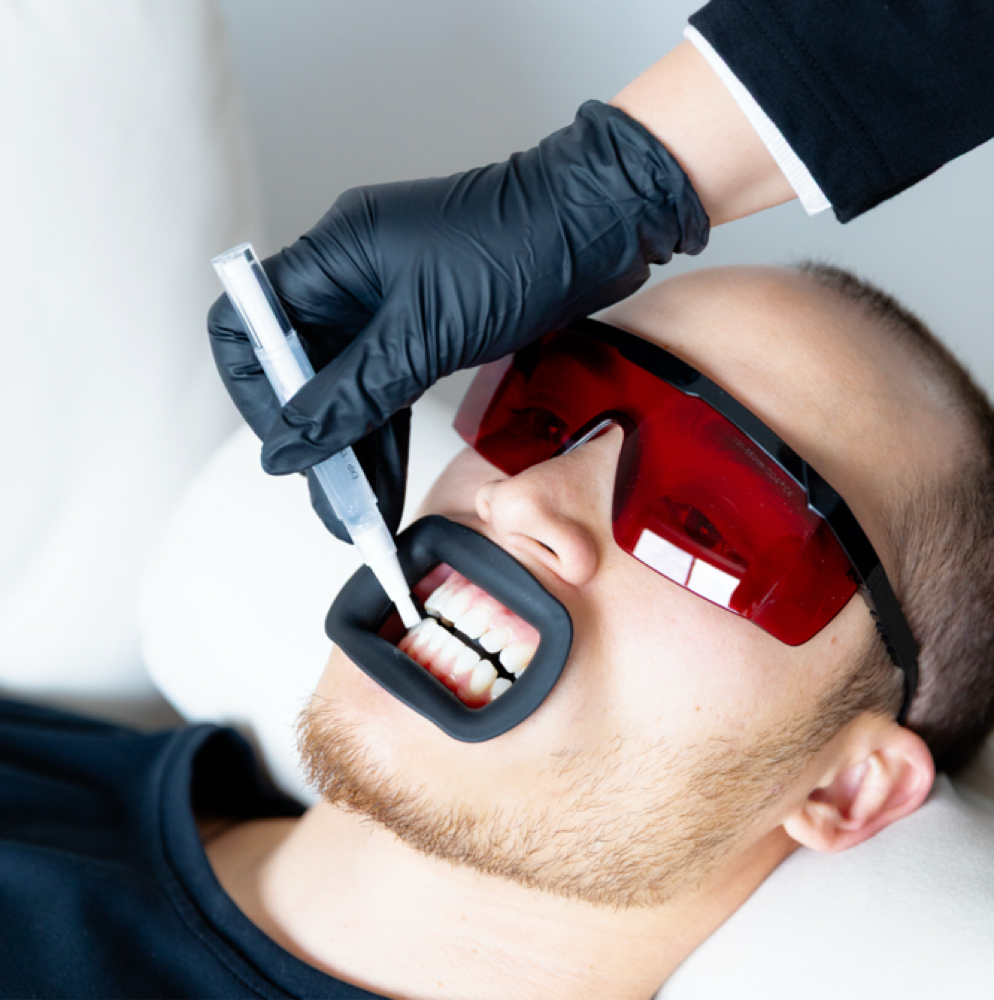 6+ Month Touch-up Whitening at Bright White Co. in Crosslake, MN