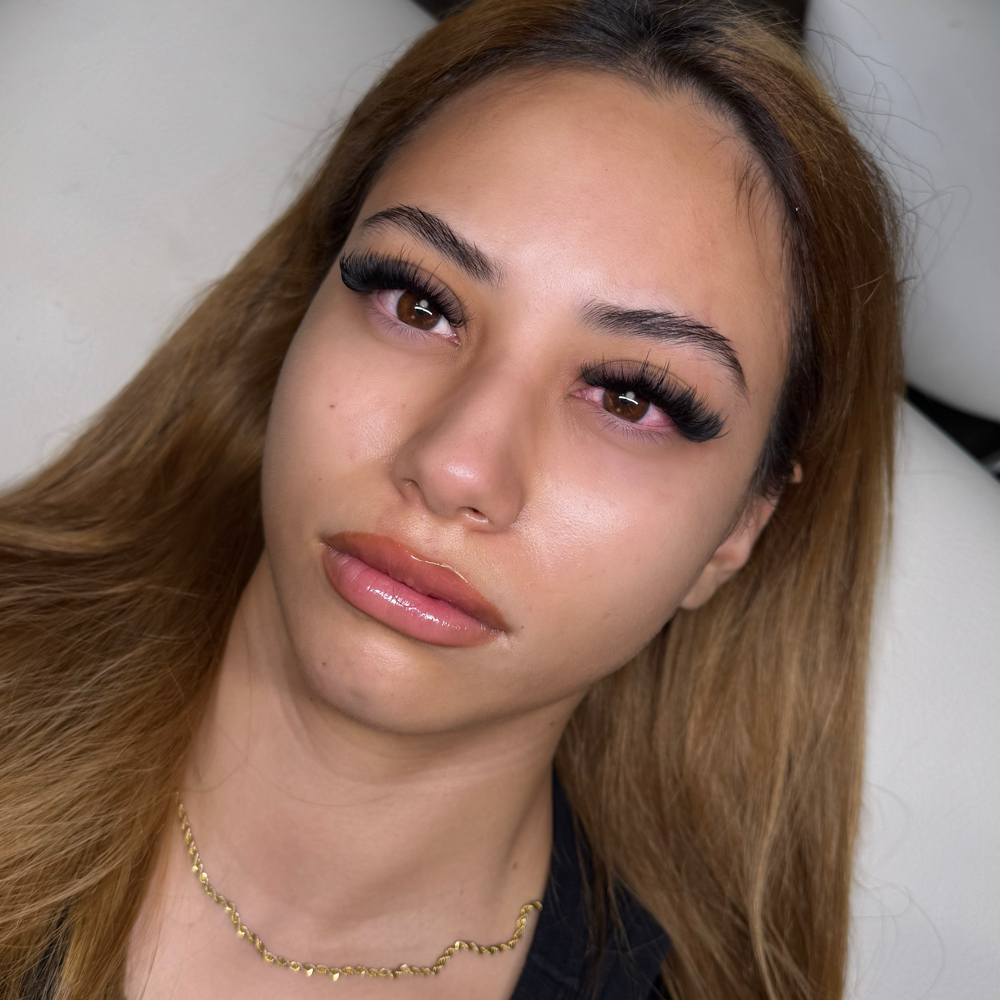 Volume Set at Hope Esthetics in Riverside, CA