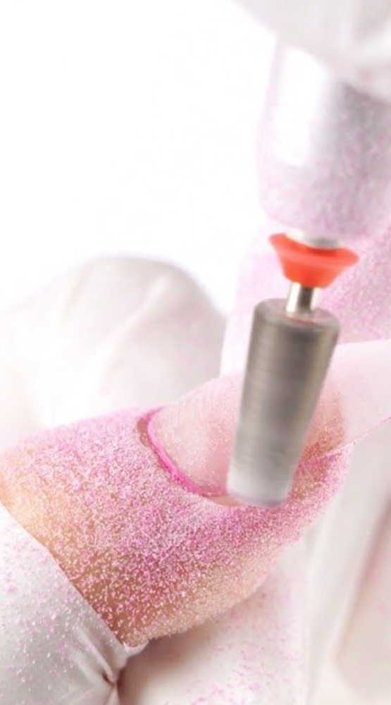 Gel Removal