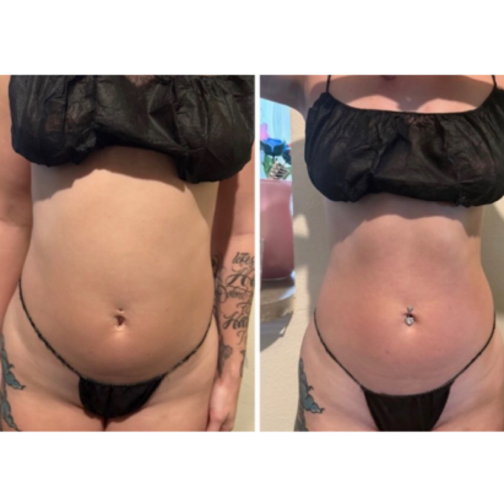 APHRODITE LUXE TREATMENT ⏳✨ at Aphrodite Curves in Amarillo, TX