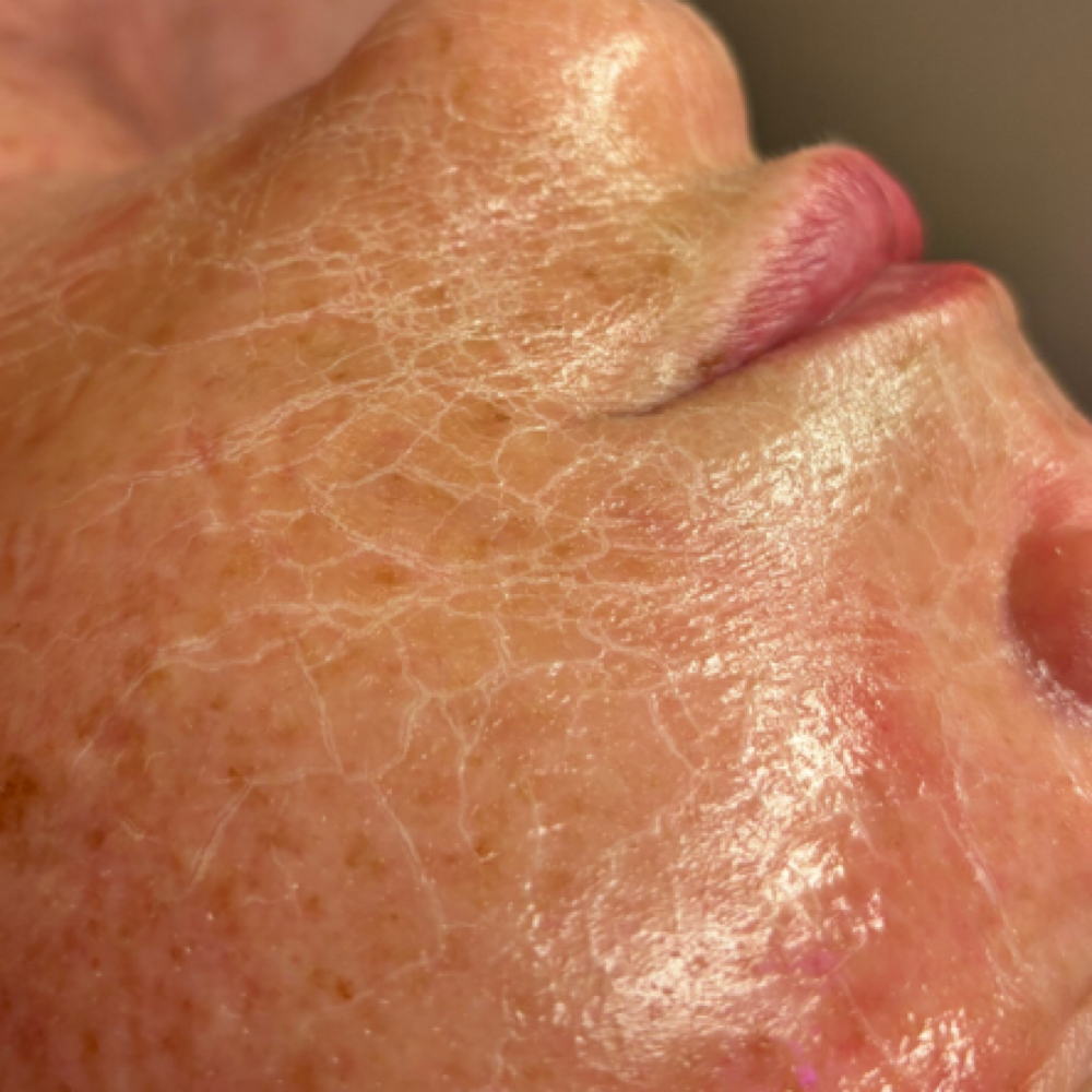Firming Peptide Mask (add On) at Bre & Me Esthetics in Delaware, OH