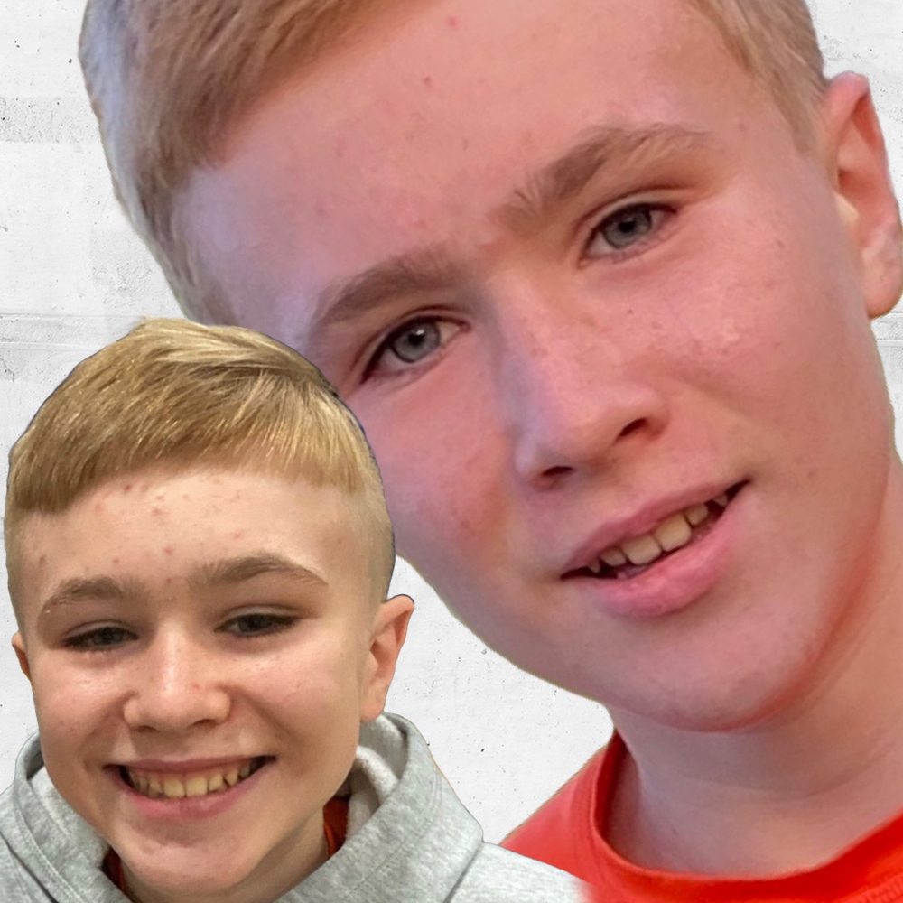 Teen Facial