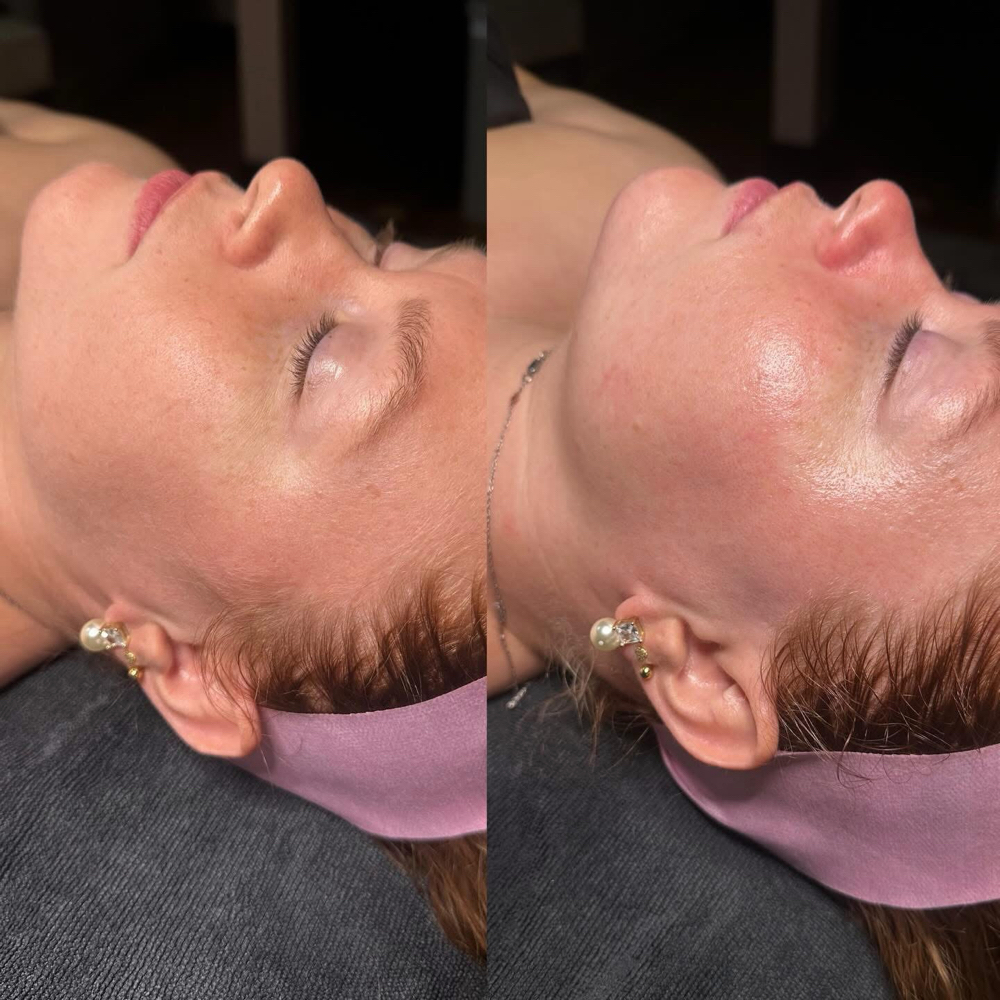 Glow and Go Facial (Dermaplane) at KW Beauty in Murphy, NC