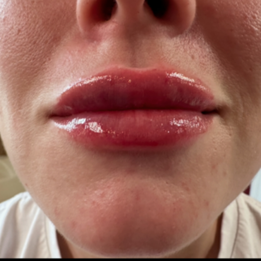 Lip Tease at Sabrina Star in Dallas, TX