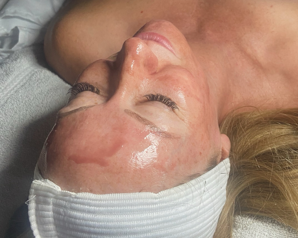Express Facial