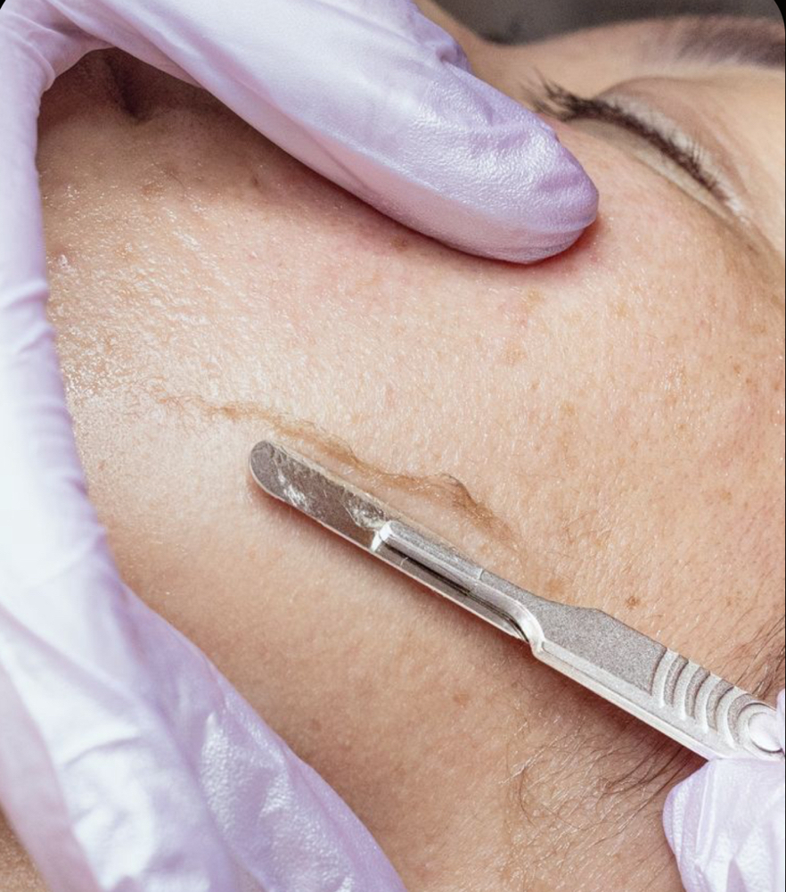 Dermaplane Facial