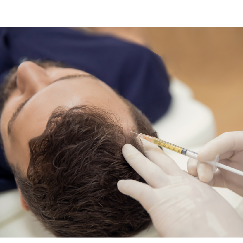 PRP for hair loss at Rei’A Esthetics in Yonkers, NY