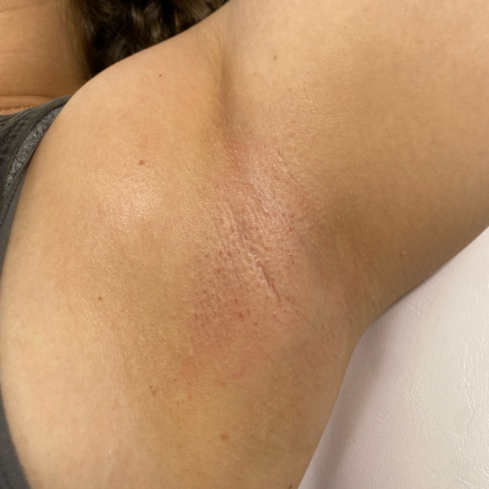 Armpit Wax at Waxura Studio in Martinsburg, WV