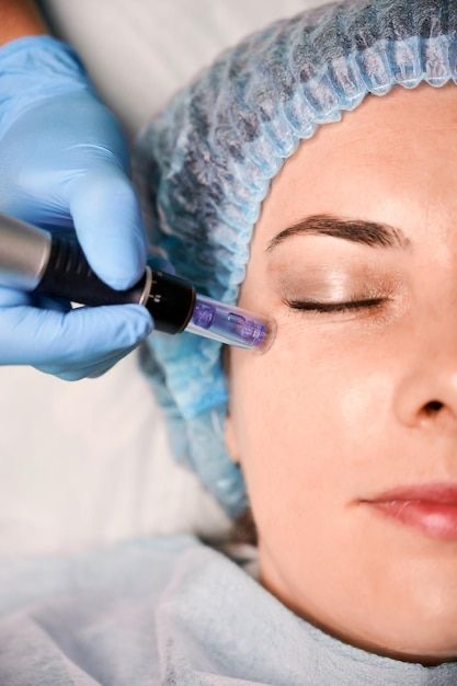 Facial + Microneedling with serum