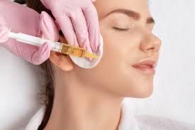 PRP Injections-Face