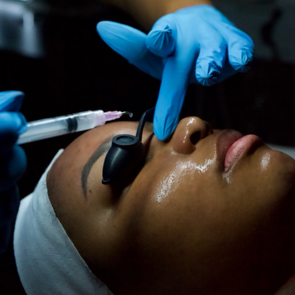REGENERATION | MICROCHANNELING at Advanced Esthetics Dallas Acne Clinic in Richardson, TX