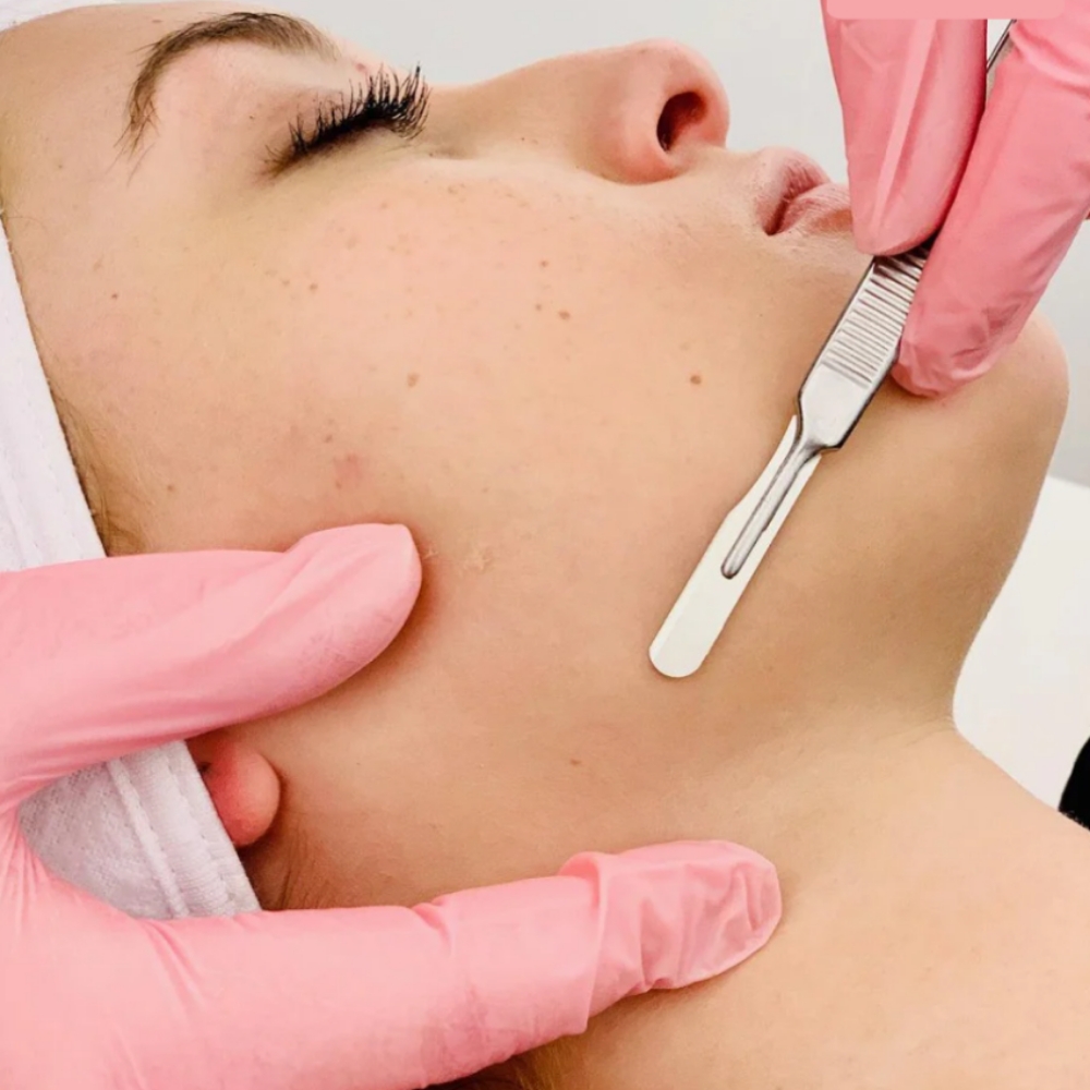 Dermaplaning Facial