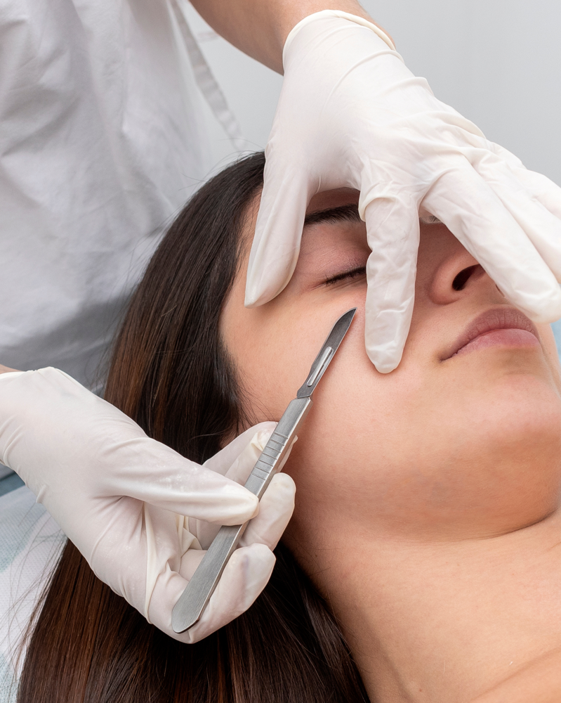 Dermaplaning