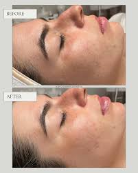 Coastal Balancing Facial