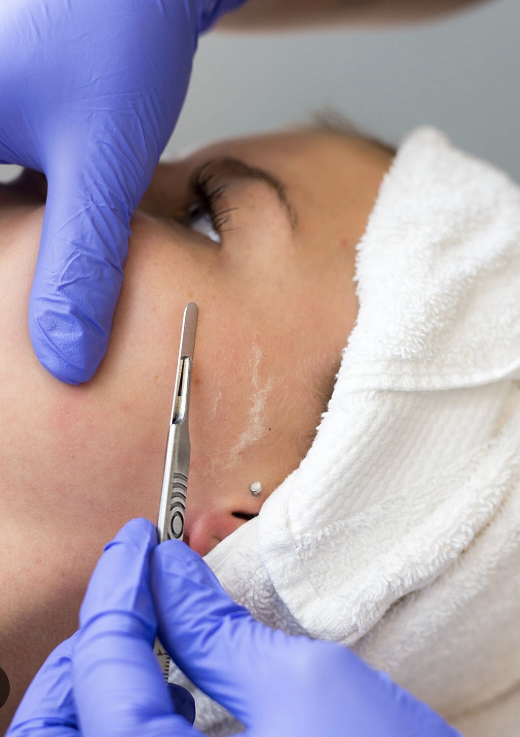 Dermaplaning Facial