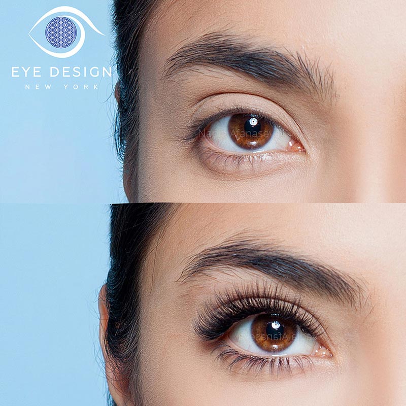 Eyelash Extansion