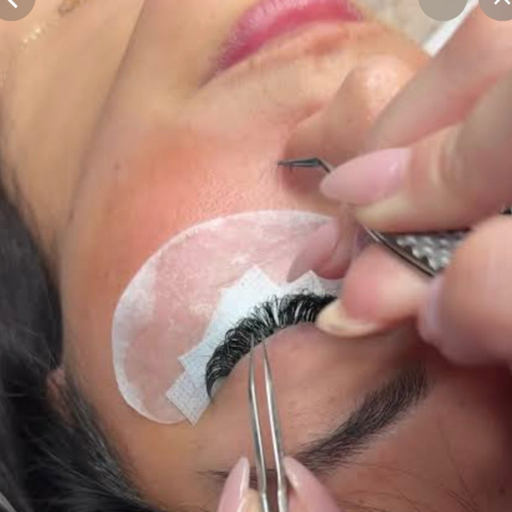 Volume Fill (2 Weeks) at Aura Aesthetics spa in Houston, TX