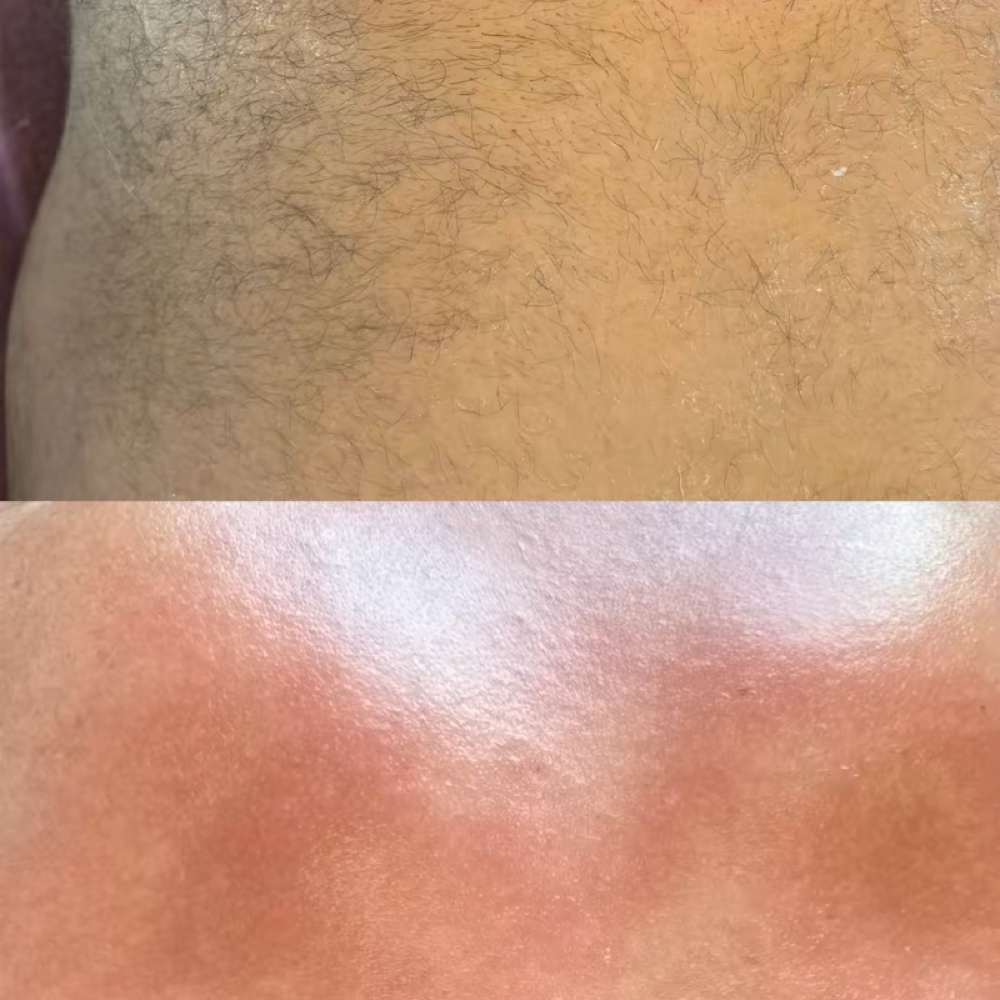 Stomach Waxing at Beauty Esthetics Loft in Denver, CO