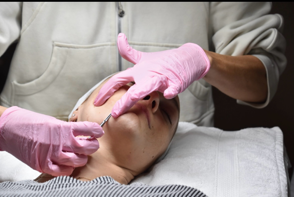 DERMAPLANE ADD ON at Skin Aesthetics Studio in East Bernard, TX