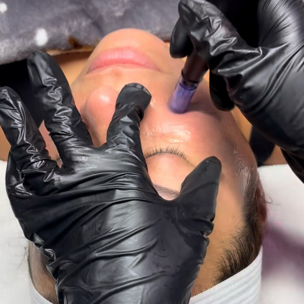 The Glass Skin Method at Summer Lynn Aesthetics in NY, NY