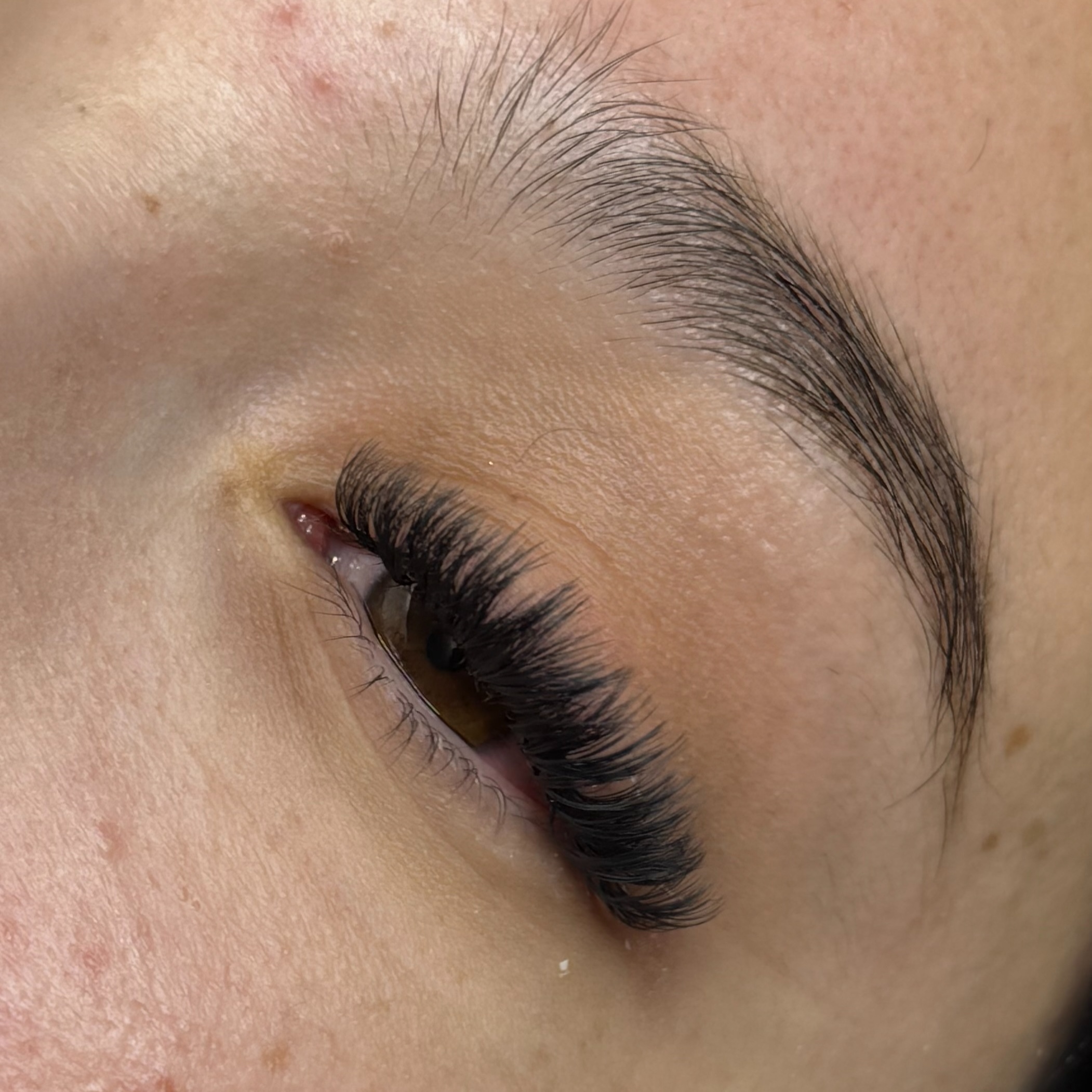 3 week fill (15-21 days) at Sage & Skin in Salinas, CA