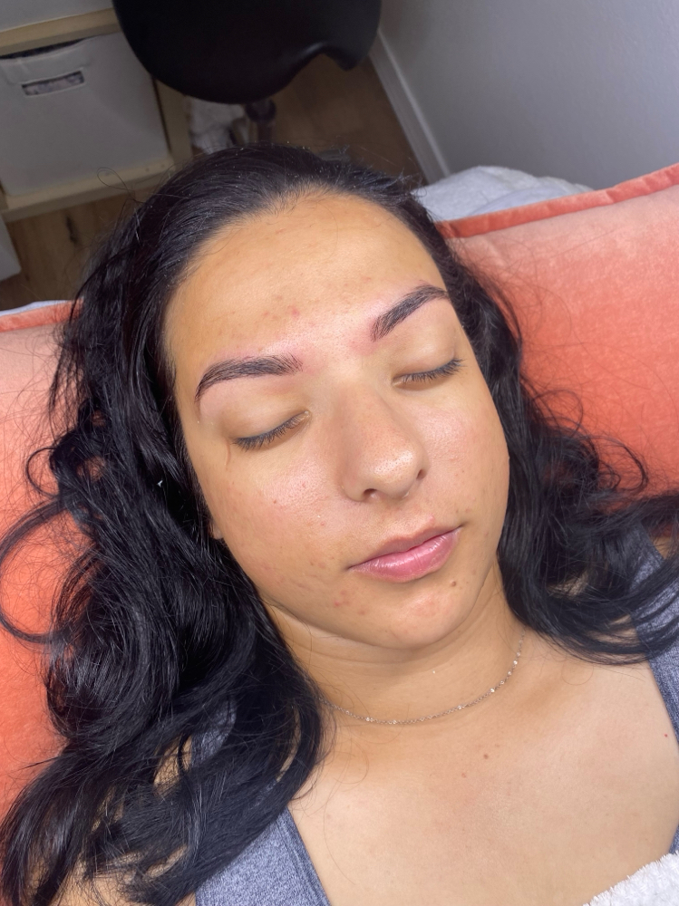Dermaplane Facial