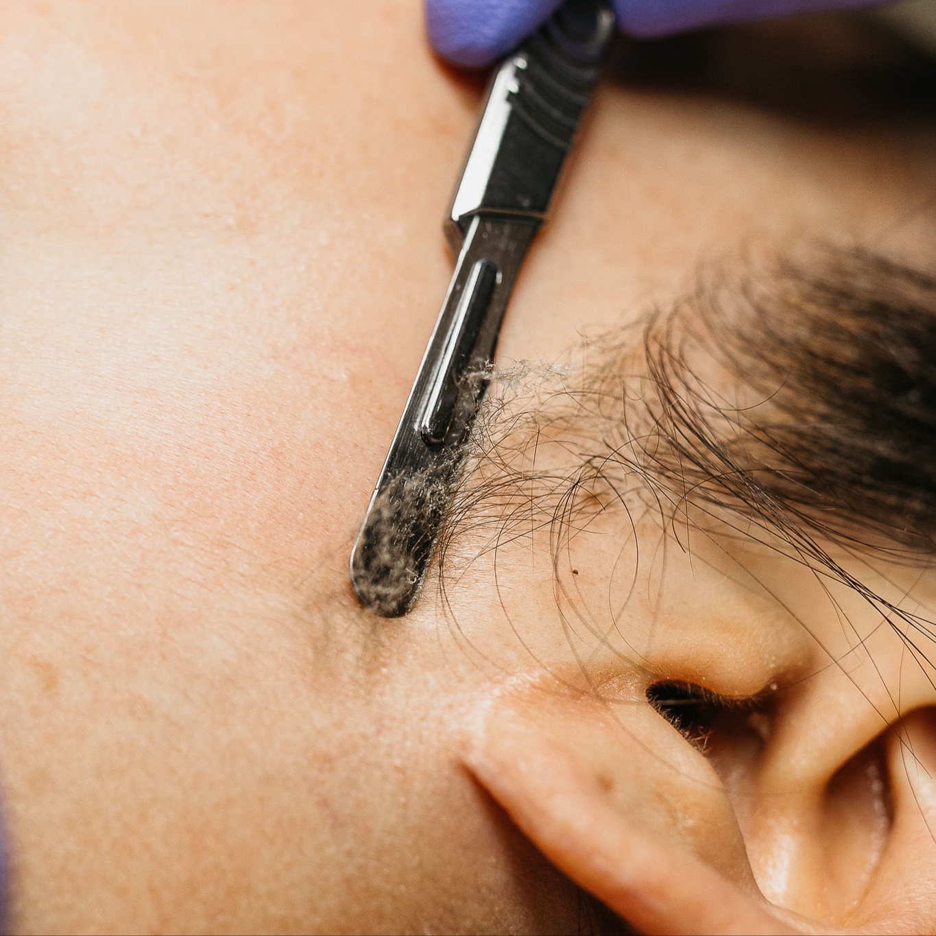 Dermaplane Express Facial at SoLuna Aesthetics in Scottsdale, AZ