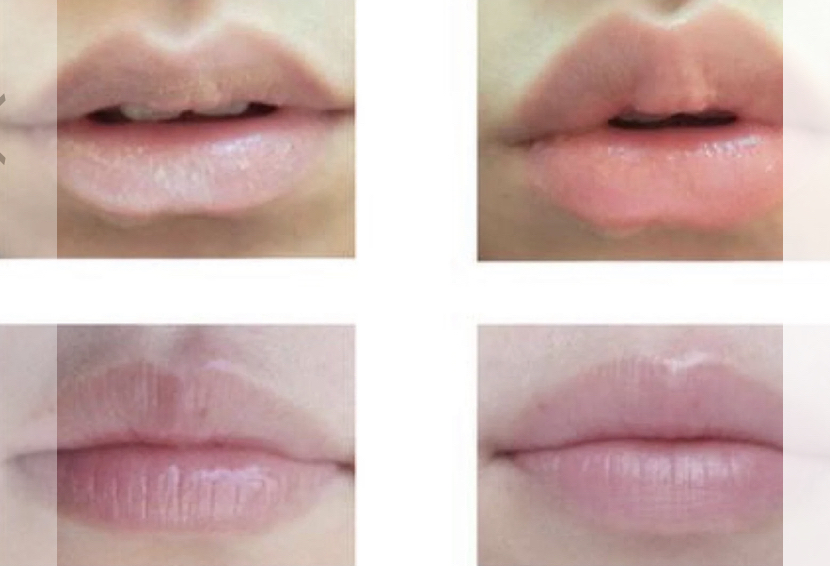 Collagen Lip Mask