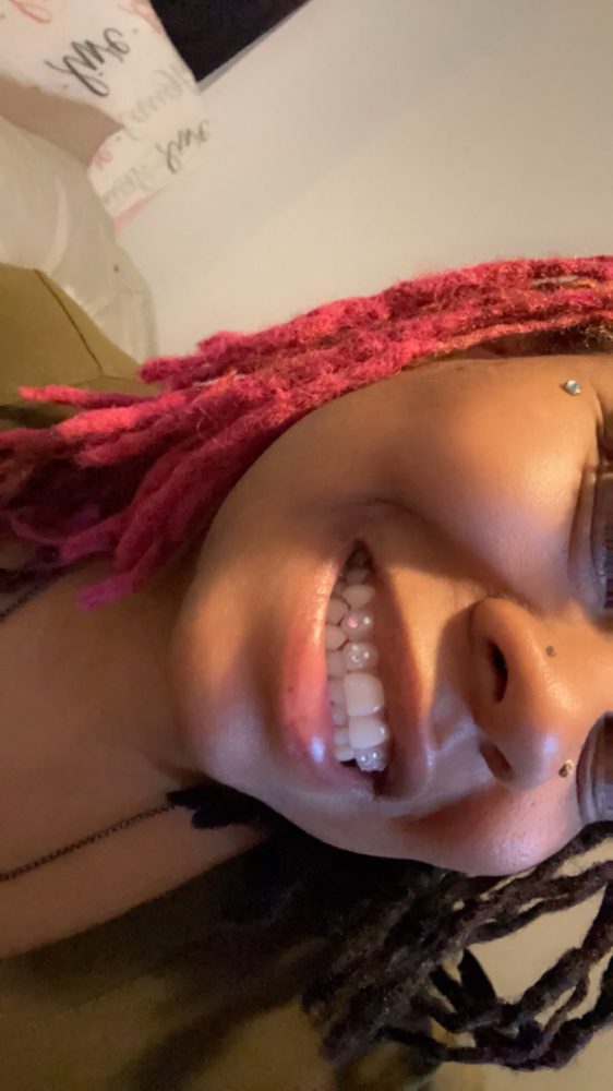 Tooth Gems